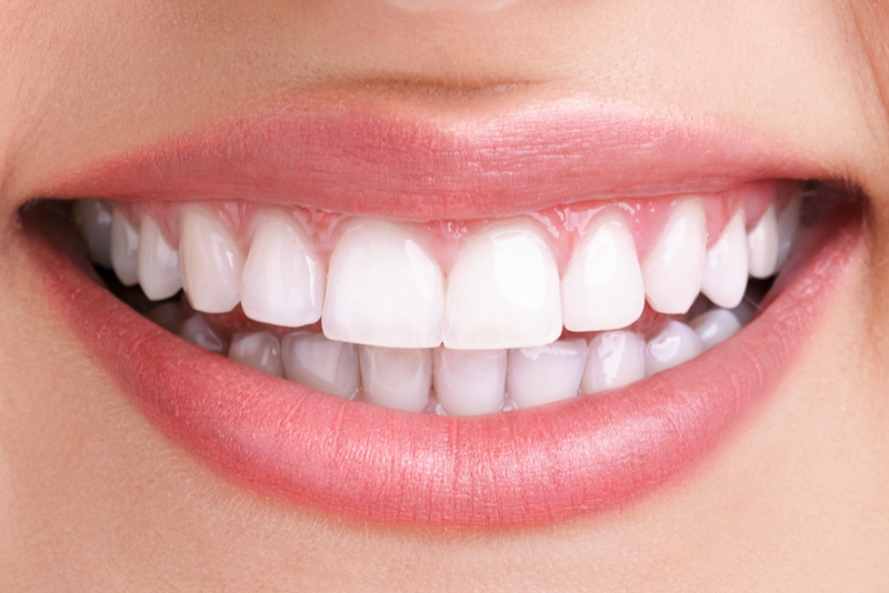 Up-close image of a smiling woman before teeth whitening