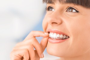 Smiling women with veneers